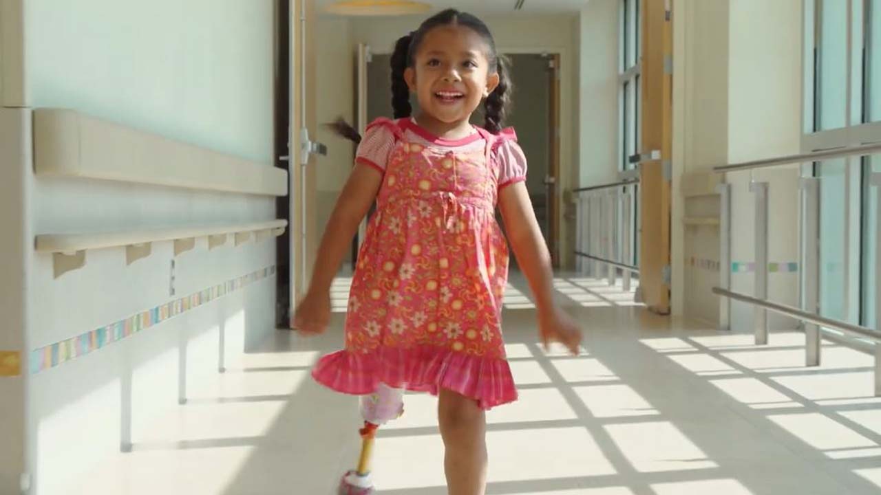 Girl with prosthetic leg walking in hospital hallway 